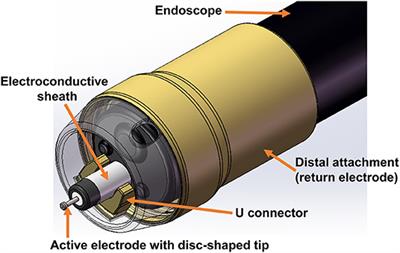 A Novelly Developed Bipolar Needle Knife Can Be an Alternative Device Choice for Endoscopic Submucosal Dissection (With Video)